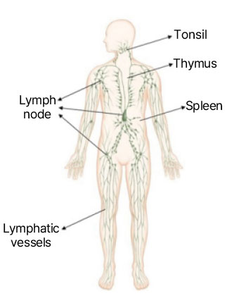 Lymphoma