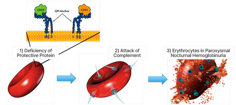 The Abnormal Erythrocyte Destruction Process in Patients with Paroxysmal Nocturnal Hemoglobinuria