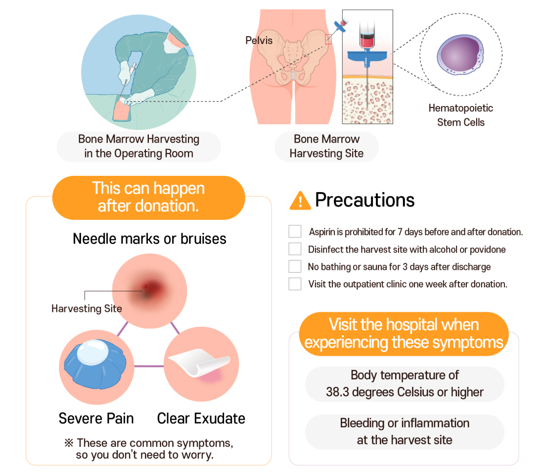 Guide to bone marrow hematopoietic stem cell donation