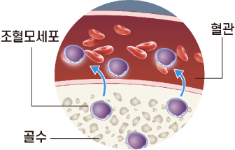 생착 예시 이미지