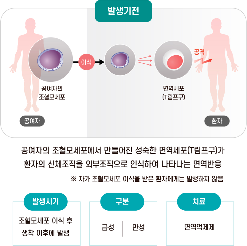 이식편대숙주질환