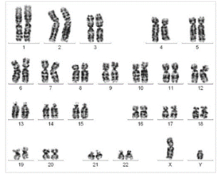 Normal Male Chromosome example image